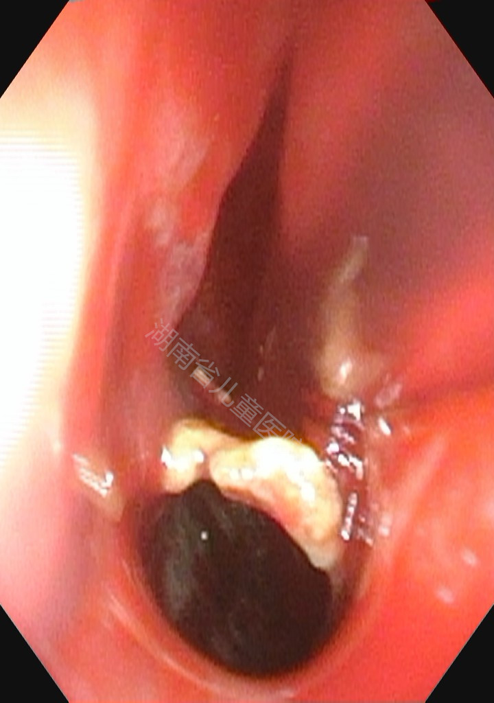 ONrXIZ4RwK6a2bc37972148.jpg