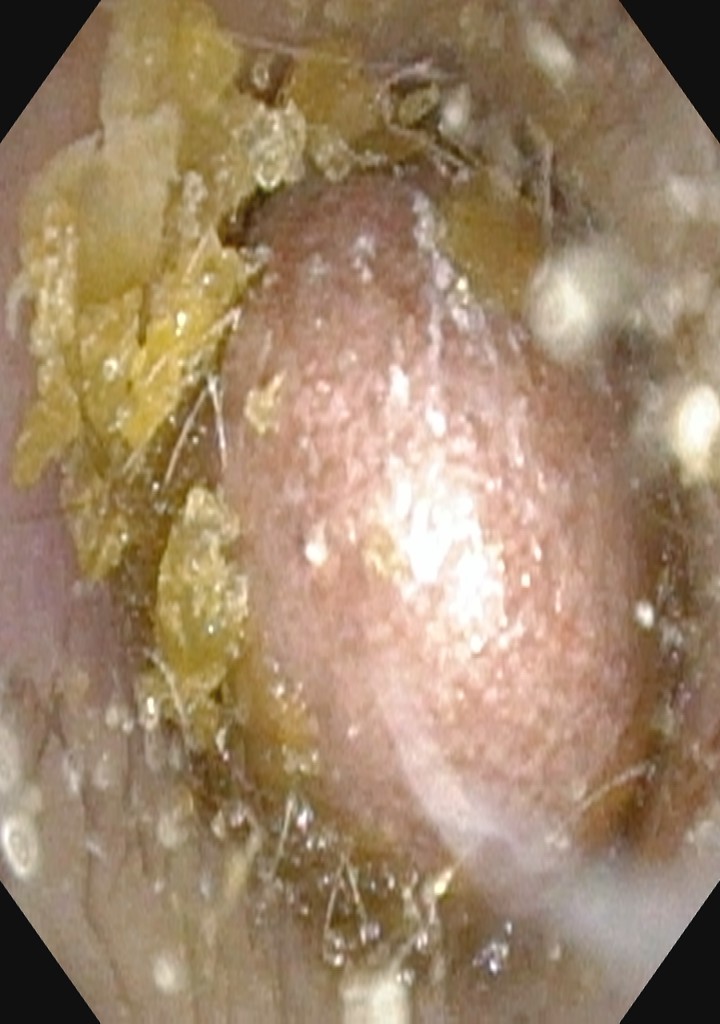 mdMzrwgnuo6a2f5c5d1ef09.jpg